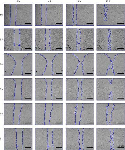 In vitro cell migration quantification method for scratch 